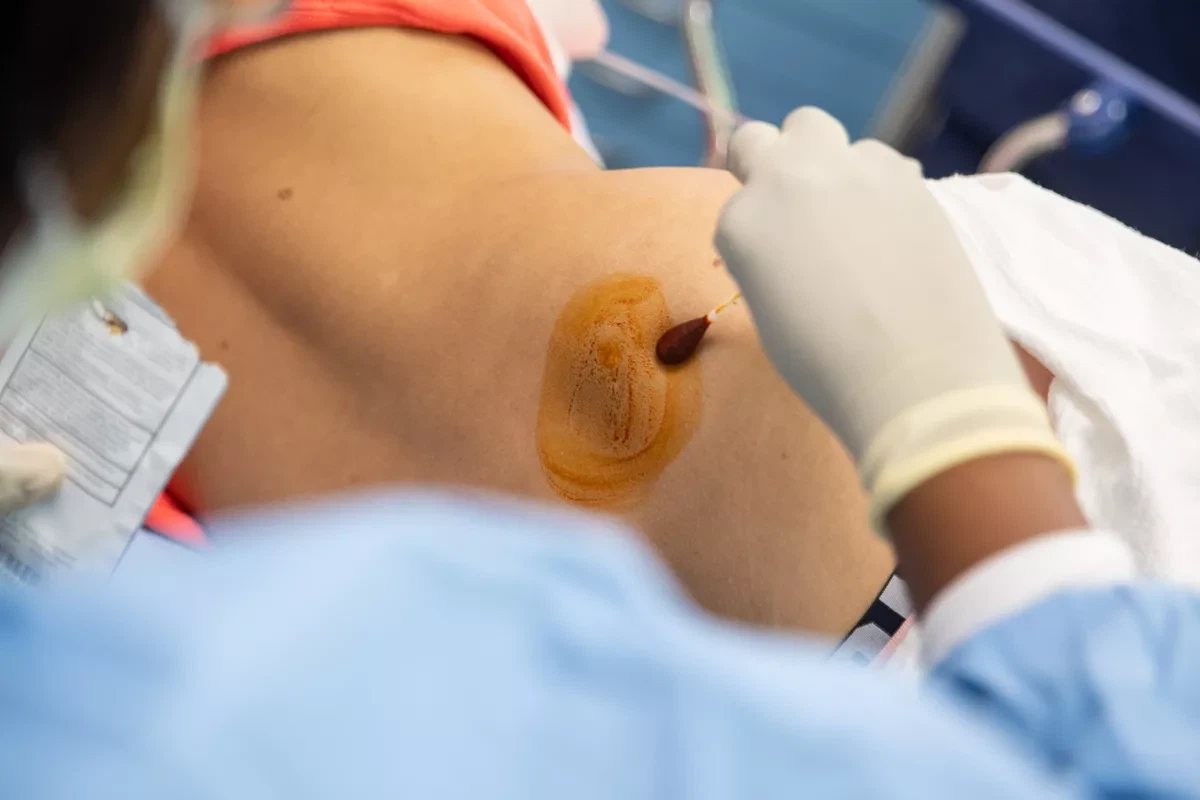 Kaulų čiulpų biopsija paaiškinta: procedūra, naudojimas ir atsigavimas