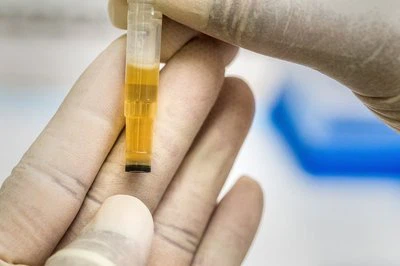 Mikroadatų technologija: biomedicinos inžinerijos{0}}sąsajos šydo pakėlimas